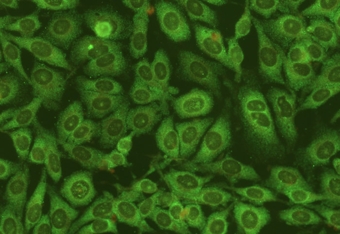 Pattern-cytoplasmic-p2